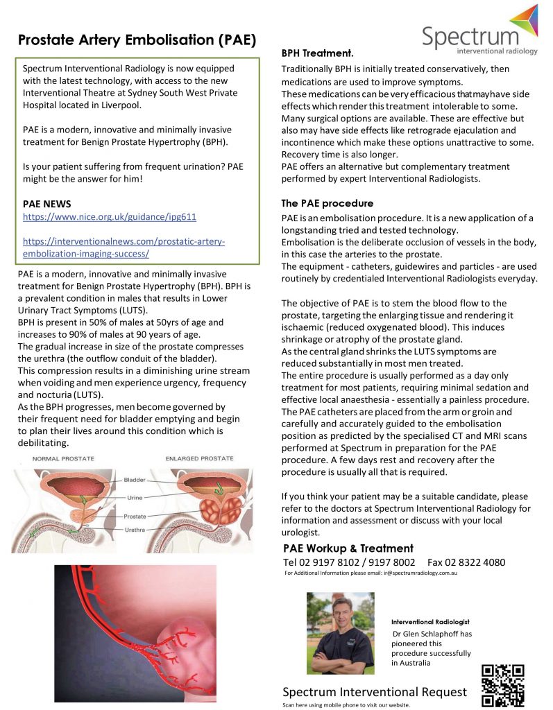 Prostatic Artery Embolisation Gp Voice