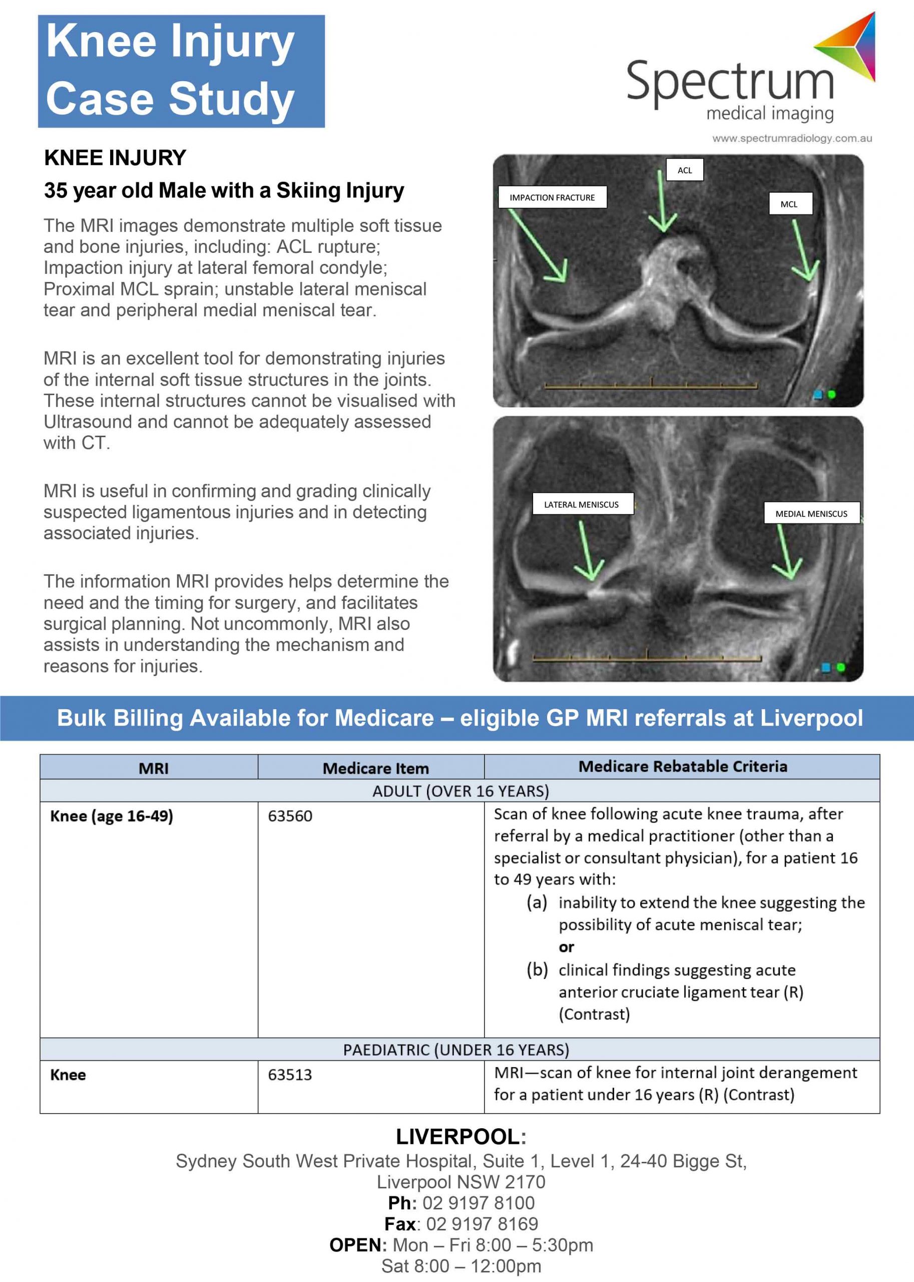 Knee MRI under Medicare who qualifies? GP Voice