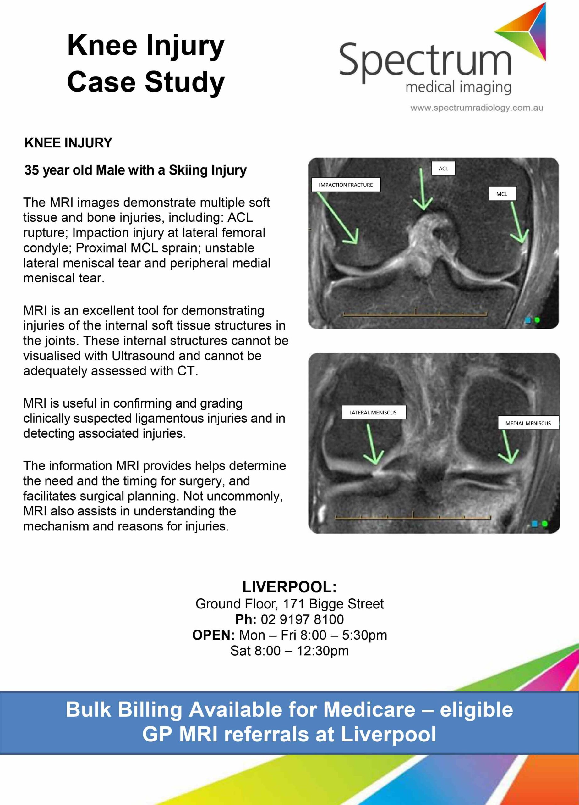 Knee MRI the best investigation to elucidate the diagnosis GP Voice